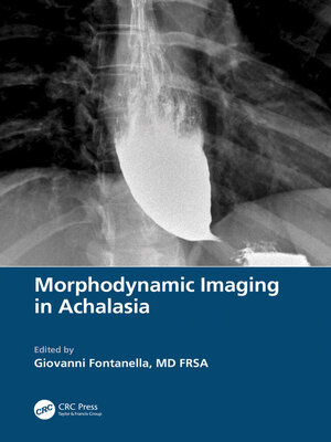 cover image of Morphodynamic Imaging in Achalasia